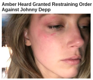 Amber heard domestic violence